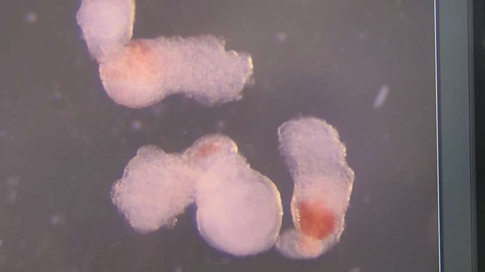 Hematoides no dia 14 apresentam um fenótipo hemogénico avermelhado com contração, segundo a Cell Reports