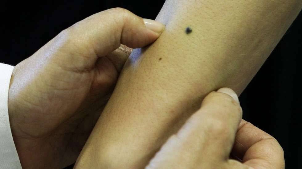 O Perfil Nacional de Cancro indica que nos casos da leucemia infantil ou dos cancros mais comuns o desempenho de Portugal é superior à média da UE