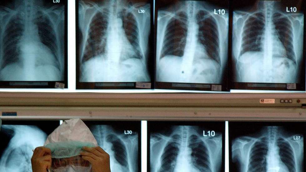 Um médico ajusta a sua máscara em frente a Raio-X de pacientes na Universidade de Taiwan