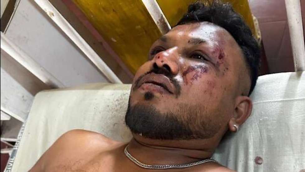 Sentado no lugar 11A, o homem de 40 anos saiu apenas com ferimentos de um acidente que causou mais de 290 vítimas mortais