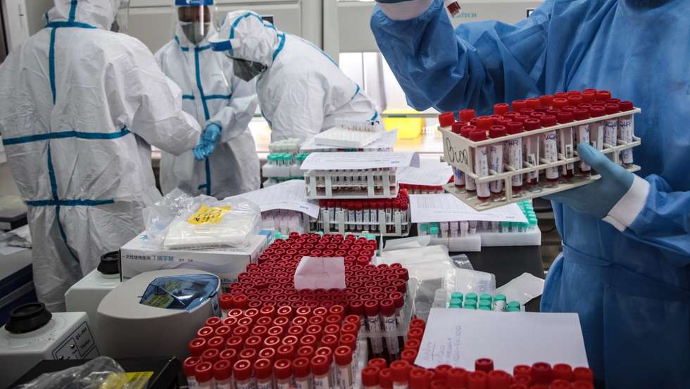 O cientista angolano Dr. Valdemar Tchipenhe (D) coordena o Centro de Diagnóstico Laboratorial de Viana que trabalha no diagnóstico das infeções por covid-19 em Angola, Luanda, 25 de setembro de 2020. (ACOMPANHA TEXTO DE 12/10/2020) AMPE ROGÉRIO/LUSA