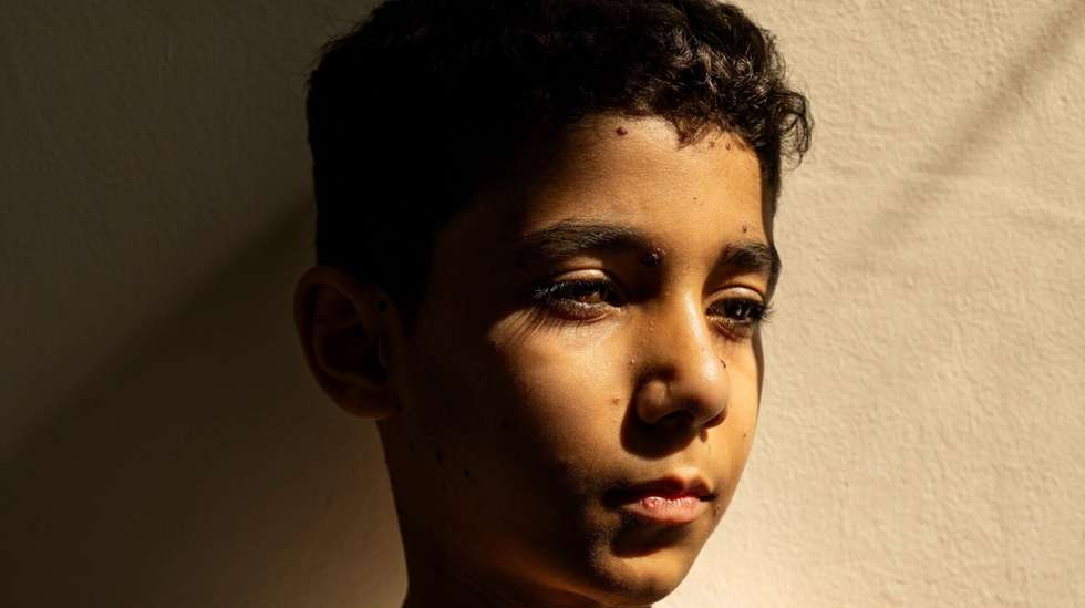 epa12036327 A handout photo made available by the World Press Photo Foundation shows the 2025 World Press Photo of the Year winning image by Samar Abu Elouf for The New York Times depicting Mahmoud Ajjour (9), who was injured during an Israeli attack on Gaza City in March 2024, finds refuge and medical help in Qatar. Doha, Qatar, 28 June 2024 (reissued 17 April 2025). The 2025 World Press Photo Winners were announced by the World Press Photo Foundation on 17 April 2025.  EPA/SAMAR ABU ELOUF / WORLD PRESS PHOTO FOUND / HANDOUT MANDATORY CREDIT: SAMAR ABU ELOUF FOR NEW YORK TIMES/WORLD PRESS PHOTO FOUNDATION -- NO COVERS -- NO CROPPING, RESIZING, MANIPULATING -- NO SOCIAL MEDIA USAGEHANDOUT EDITORIAL USE ONLY/NO SALES