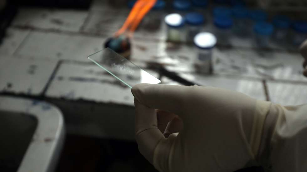 epa08621827 Sample for TB tests being processed in Designated Microscopy Centers at Dharmsala under National National Tuberculosis Elimination Programme India 24 August 2020. According to the news reports National Tuberculosis Elimination Program has been implemented in Himachal Pradesh with active tuberculosis case finding campaign as end game strategy to reach the goal of TB free India by 2025 where the health teams visit the people in vulnerable areas to enquire about TB symptoms at the doorstep and collect samples. Indian TB program witnessed a rapid scale up of outreach services through vast network of community volunteers.  EPA/SANJAY BAID