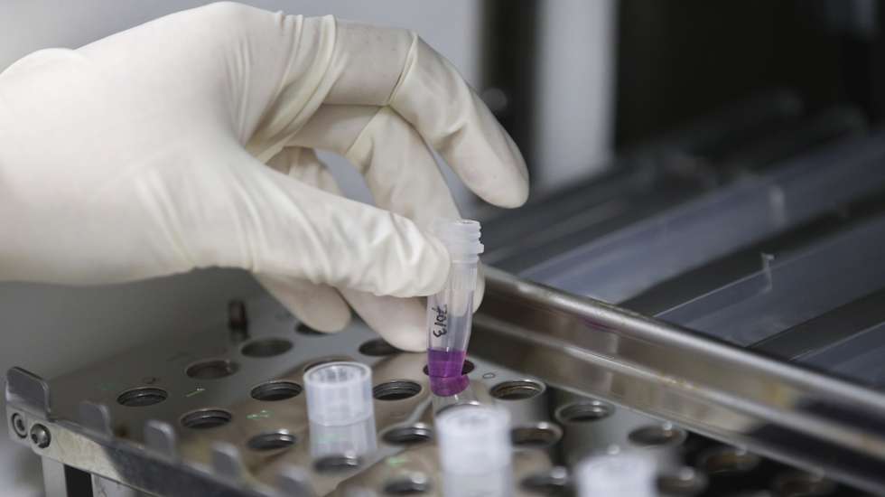 epa10101170 A Thai medical technologist works to conduct a test for monkeypox virus at the laboratory of Thai Red Cross Emerging Infectious Diseases Health Science Center, King Chulalongkorn Memorial Hospital in Bangkok, Thailand, 01 August 2022. Thailand is on alert and steps up the screening of air travelers from countries reporting the outbreak of monkeypox as a precaution against the virus after two people in the country had been confirmed infected with monkeypox.  EPA/RUNGROJ YONGRIT