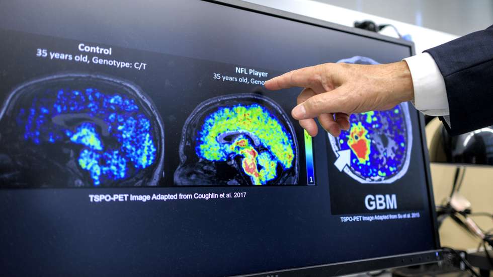 epa12386001 Dean of Robert Stempel College of Public Health &amp; Social Work at Florida International University Doctor Tomas R. Guilarte talks about the images of quantitative autoradiography displayed on a computer screen in his lab at Florida International University in Miami, Florida, USA, 17 September 2025. Florida International University is investigating Translocator Protein (TSPO), a biomarker of neuroinflammation, and its role in the progression of Alzheimer's disease. Early findings show that TSPO levels increase well before memory loss occurs, offering hope for early detection and improved treatments.  EPA/CRISTOBAL HERRERA-ULASHKEVICH