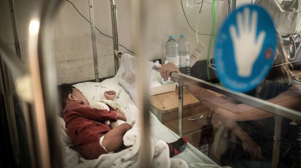 Um bebé de 10 meses após ser operado pela segunda vez ao coração devido a uma cardiopatia congênita graveno Hospital de Santa Marta, em Lisboa, 14 de novembro de 2019. A Cardiologia Pediátrica surgiu em Portugal em 1969 no Hospital de Santa Marta, com a criação pela Professora Doutora Fernanda Sampayo de uma consulta específica. Naquela unidade, fazem-se transplantes a bebé a partir de um ano, cateterismos a prematuros e todo o tipo de tratamentos em bebés com problemas no coração. (ACOMPANHA TEXTO DO DIA 16 DE NOVEMBRO DE 2019). MÁRIO CRUZ/LUSA