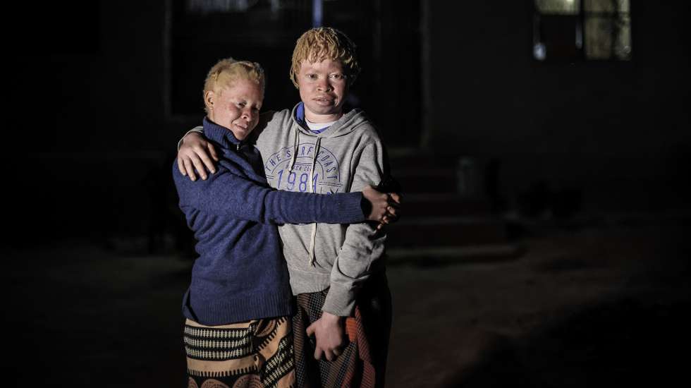 epa11658491 18-year-old Julia (L) and 17-year-old Faustina (R), two teenage girls with albinism, pose for a photo in Chimoio, Mozambique, 01 October 2024 (issued 14 October 2024). Julia abandoned school following repeated harassment by her teacher who called her "girl of one color alone". Faustina's brother, who shared the same skin pigmentation of his sister, was killed and mutilated for the sale of organs and his body was found in the trash. "All people are different in color, I don’t understand why they treat us like that", she says. Her mother, Chica, still shaken by the loss of her son, now fears for her daughter to be kidnapped and face her brother's fate. According to Amnesty International, in Mozambique and other African countries there are those who believe that body parts from albino people can have magical powers, and that having sex with a person living with albinism cures HIV and AIDS. Attackers sell albino body parts to witch doctors for thousands of dollars. The Office of the United Nations High Commissioner for Human Rights (OHCHR) reported in 2016 that albino hunters could sell an entire human corpse for up to 75,000 US dollars, while their limbs could fetch about 2,000 US dollars.  EPA/JOSE COELHO  ATTENTION: This Image is part of a PHOTO SET