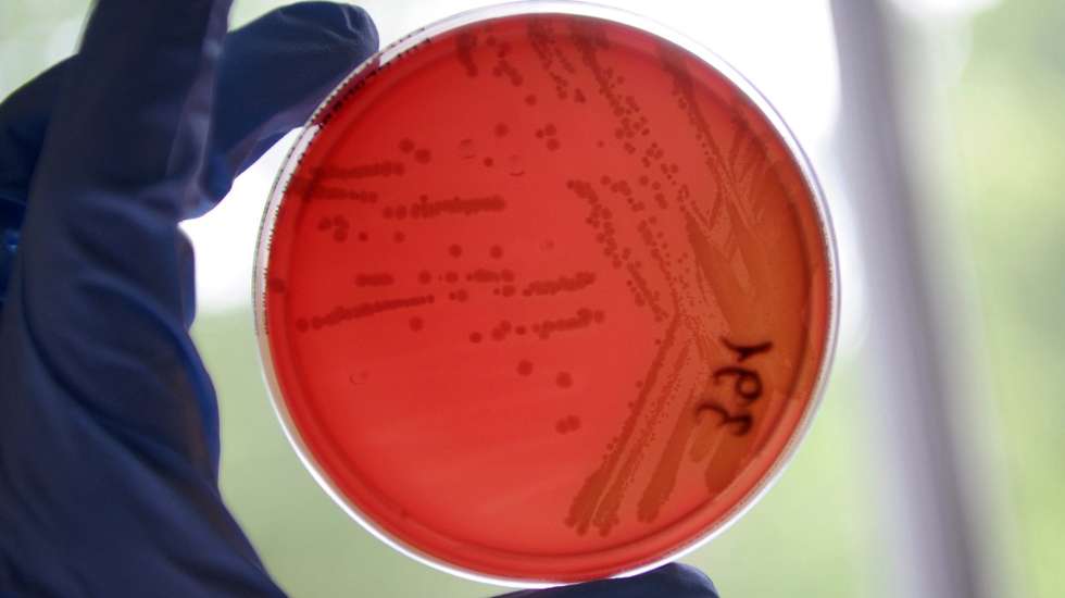 epa02749495 A Hamburg Institute for Hygiene and Environment employee holds a Petri dish that contains Escherichia coli (EHEC) bacteria strains at the university hospital in Hamburg, Germany, 23 May 2011. Germany reported its first death 24 May from a virulent super-bacterium that has spread through the north of the country in just a week, possibly via fresh produce sold in supermarkets.  EPA/Christian Charisius