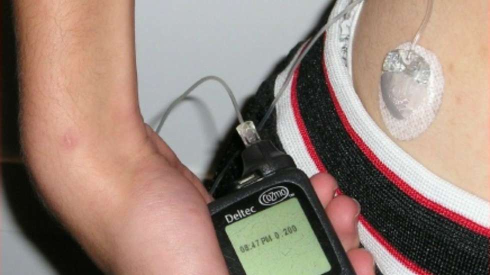 Na altura, o governante explicou que se estimava que o programa abrangesse 15 mil pessoas com diabetes tipo 1 e que os doentes deveriam começar a receber os aparelhos ainda em 2023