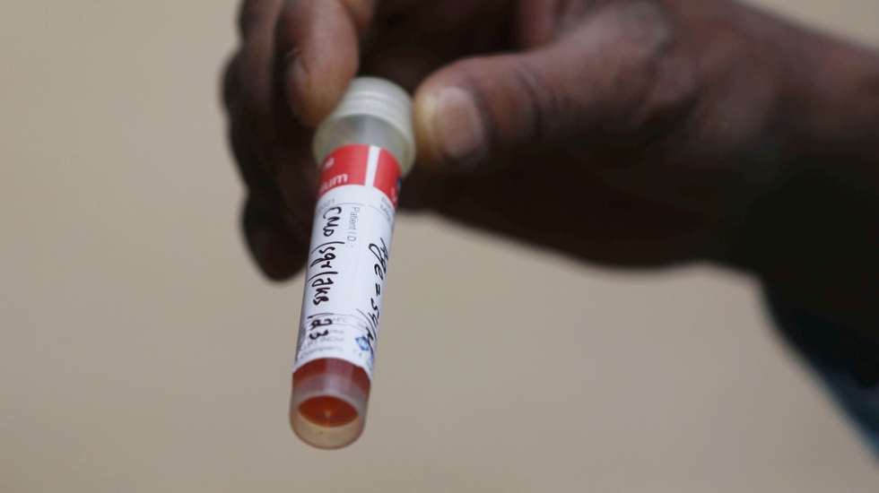 epa08549036 A man handles a vial as he waits for his turn for a swab sample collection in Srinagar, the summer capital of Indian Kashmir, 16 July 2020. The government has re-imposed lockdown restrictions in most parts of Srinagar and certain pockets of other districts to stop the spread of the infectious disease. COVID-19 cases and deaths in the region are witnessing an unusual spike since the past few days.  EPA/FAROOQ KHAN