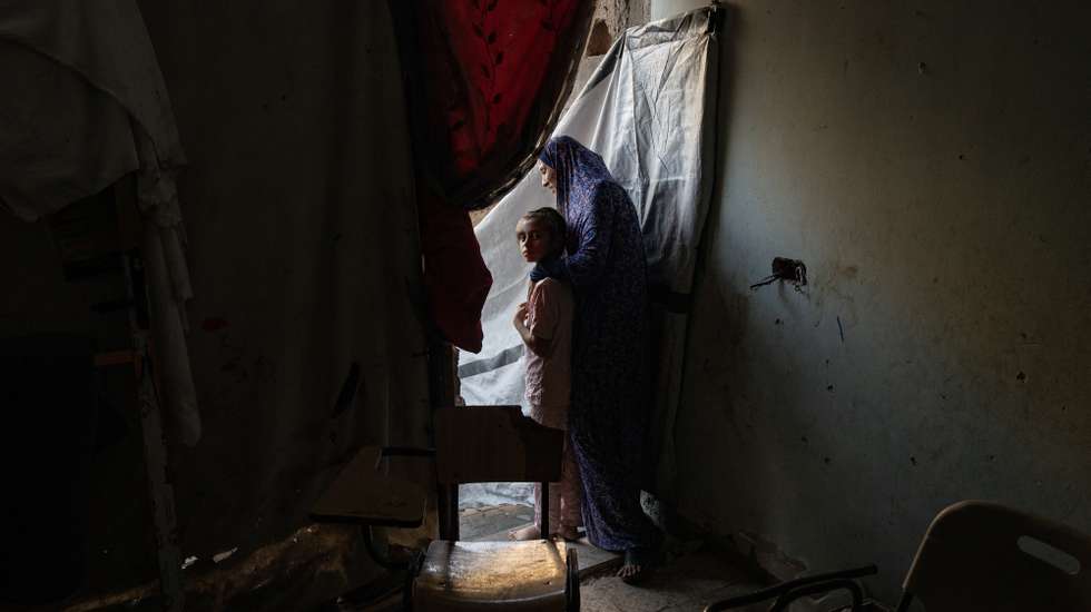 epa12305132 Maryam Ibrahim, a 12-year-old girl from Khan Younis refugee camp in the southern Gaza Strip 16 August 2025, who suffered a brain injury when struck by a missile shrapnel which caused a skull fracture, after the Israeli army targeted her family home. Doctors were forced to remove the frontal bone on the left side, which altered the natural shape of her head after a series of surgical operations. Maryam suffers from severe head pain, continuous seizures, and a dangerous rise in temperature, amid complications that threaten her life at any moment. She is in urgent need of being transferred outside Gaza to undergo surgical and reconstructive operations to save her life.  EPA/HAITHAM IMAD