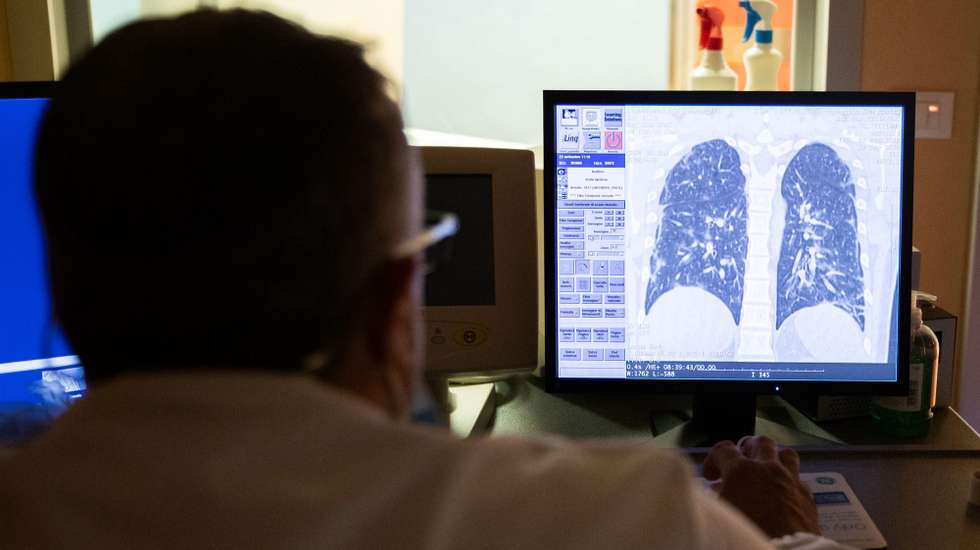epa08691184 A doctor of the Casal Palocco Clinical institute checks the x-ray of the lungs of a hospitalized boy with COVID19 in, Rome, Italy, 23 September 2020. The Clinical institute, transformed into a hospital for COVID19 patients during the coronavirus emergency, reached zero cases during July. Hospitalizations and intensive care recovery for COVID19 at the COVID19 center in Casal Palocco, have increased since August reaching the peak in the last week and mainly concerns young people.  EPA/Emanuele Valeri
