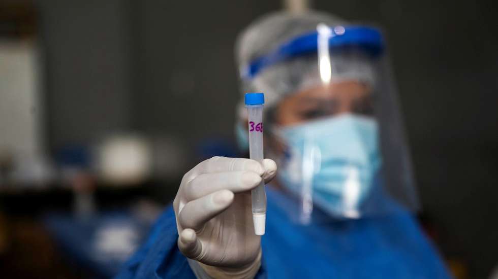 epa09007532 A nurse shows a covid-19 test in Buenos Aires, Argentina, 12 February 2021. Argentina is on its way this Friday to exceed 50,000 deaths from covid-19, a disease that has already infected more than two million people throughout the country since the beginning of the pandemic, almost a year ago, while the vaccination of the population with the Russian Sputnik-V vaccine is advancing slowly.  EPA/Demian Alday EstÃ©vez