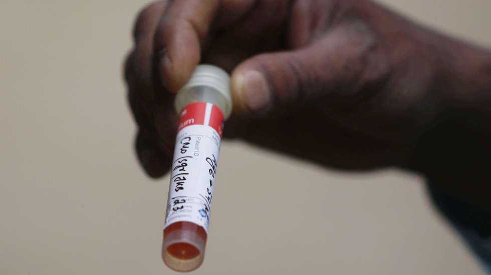 epa08549036 A man handles a vial as he waits for his turn for a swab sample collection in Srinagar, the summer capital of Indian Kashmir, 16 July 2020. The government has re-imposed lockdown restrictions in most parts of Srinagar and certain pockets of other districts to stop the spread of the infectious disease. COVID-19 cases and deaths in the region are witnessing an unusual spike since the past few days.  EPA/FAROOQ KHAN