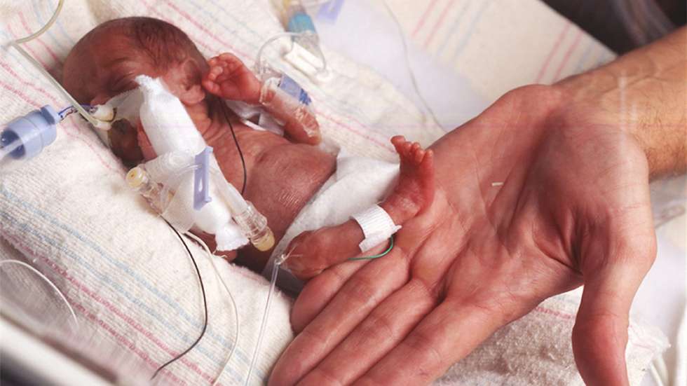 epa000333743 (FILES) A undated handout photo of newborn Rumaisa Rahman, barely larger than an adult hand at Loyola University Hospital in the Chicago suburb of Maywood, Illinois. Rumaisa and twin sister Hiba were born premature on 19 September 2004 and Rumaisa was the smallest surviving newborn in the world when she arrived at 8.6 ounces, the size of a cellular phone. Sister Hiba came into the world at 1 pound 4 ounces. Both babies are doing fine and are expected to go home soon.  EPA/HANDOUT