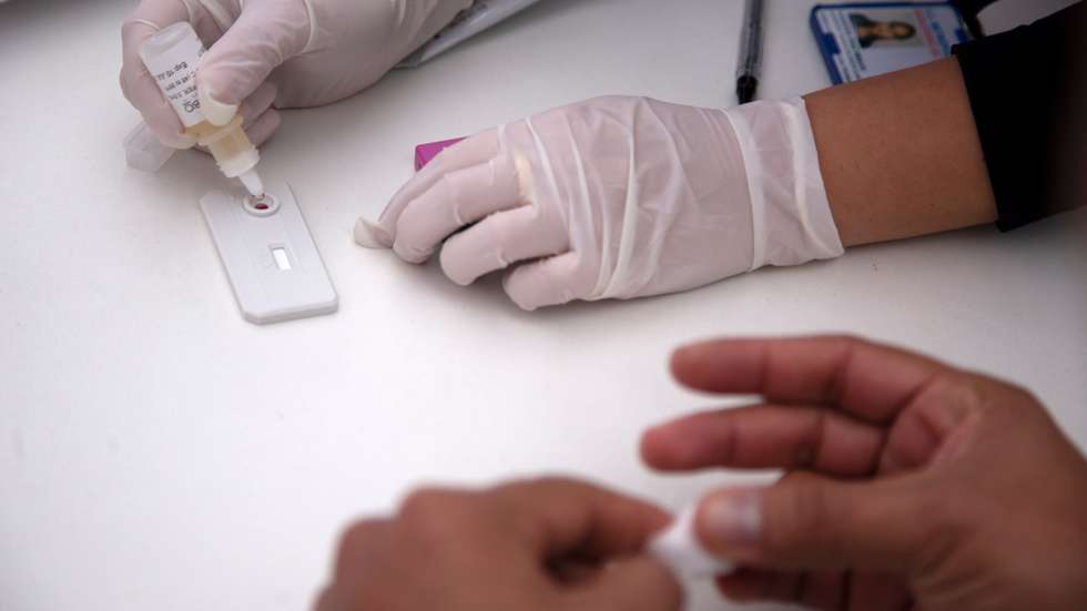 Os números apresentados pela DGS e pelo INSA confirmam a tendência de descida dos últimos anos, uma vez que entre 2009 e 2018 ocorreu uma queda de 47% no número de novos casos de infeção por VIH e de 65% em novos casos de SIDA