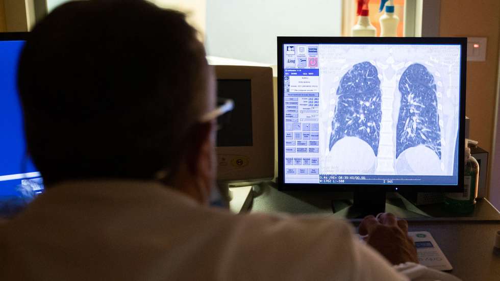 epa08691184 A doctor of the Casal Palocco Clinical institute checks the x-ray of the lungs of a hospitalized boy with COVID19 in, Rome, Italy, 23 September 2020. The Clinical institute, transformed into a hospital for COVID19 patients during the coronavirus emergency, reached zero cases during July. Hospitalizations and intensive care recovery for COVID19 at the COVID19 center in Casal Palocco, have increased since August reaching the peak in the last week and mainly concerns young people.  EPA/Emanuele Valeri
