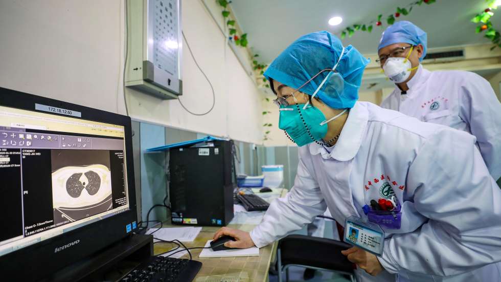 epa08180541 Dr. Zhang Jixian (C) checks CT images of a patient at a hospital in Wuhan, Hubei province, China, 30 January 2020 (issued 31 January 2020). The World Health Organization (WHO) declared the novel coronavirus outbreak in China a global emergency after the numbers of cases and affected countries grew in the past days.  EPA/YUAN ZHENG CHINA OUT
