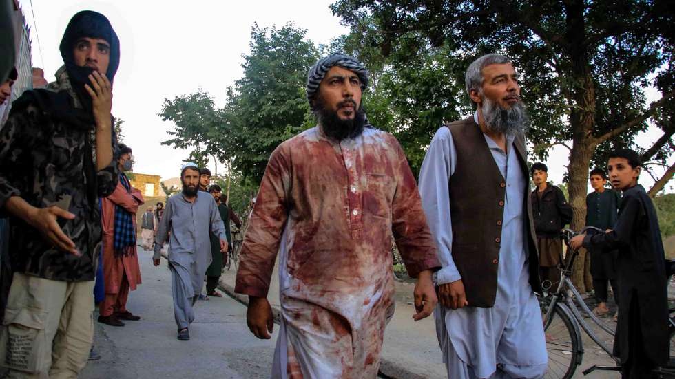 epaselect epa09917096 People who were injured leave the scene of the bomb blast in Kabul, Afghanistan, 29 April 2022. According to police, at least ten people were killed and dozens more injured in a bombing attack on a mosque during prayers, the attack came amid a wave of strikes on Afghan religious sites and civilian targets during the holy month of Ramadan.  EPA/STRINGER