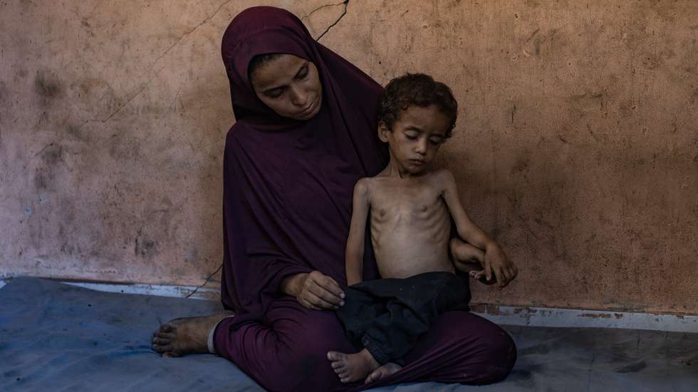 epa12247634 Palestinian child Yazan Abu Foul, aged two, is cared for by his mother Naima, as he suffers from severe malnutrition due to the acute shortage of food caused by the blockade imposed on the Gaza Strip and the closure of border crossings, in Al-Shati refugee camp, west of Gaza City, 19 July 2025. Yazan lives in harsh environmental and health conditions, with his family lacking the basic necessities of life amid a worsening humanitarian crisis. According to medical sources, the child’s health continues to deteriorate due to the lack of proper nutrition and necessary medical care. Humanitarian organizations have warned of an imminent food catastrophe threatening the lives of thousands of children in the besieged Gaza Strip, this situation coming at a time when Gaza’s residents face severe food insecurity and a sharp decline in health services, amid ongoing restrictions on the entry of humanitarian aid and essential supplies.  EPA/HAITHAM IMAD