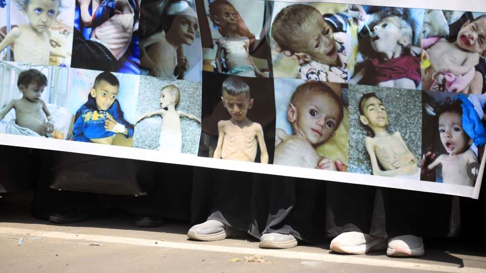 epa12256136 Protesters hold a banner showing Palestinian children suffering from severe malnutrition, during a rally calling for an end to the war on Gaza, at Sana'a University, in Sana'a, Yemen, 23 July 2025. Students and professors rallied at Sana'a University in solidarity with the Palestinian people, demanding an end to the war on the Gaza Strip and the resulting famine.  EPA/YAHYA ARHAB