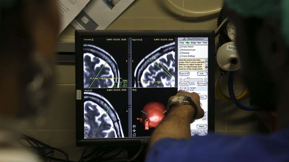 Levodopa é o fármaco indicado para o tratamento do Parkinson
