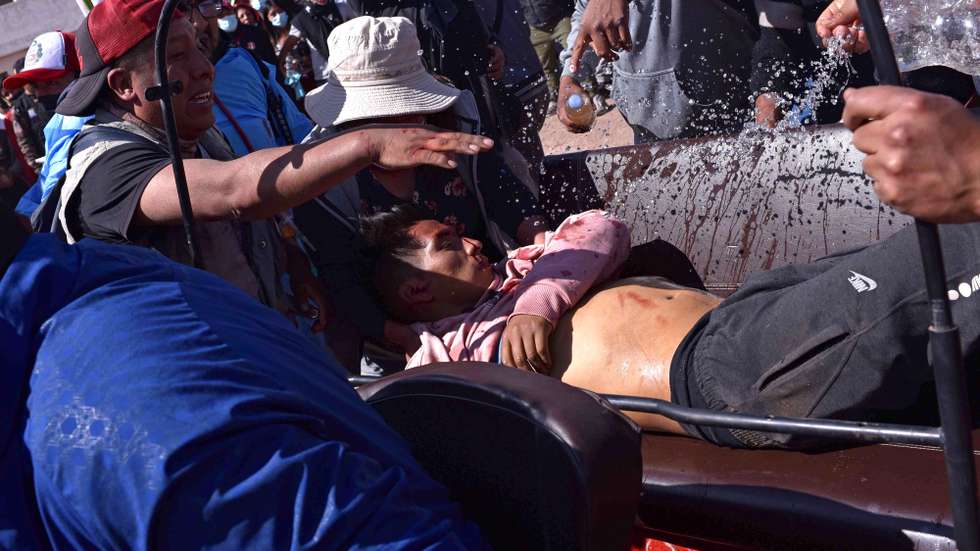 epa10397387 A man injured in clashes between protesters and security forces is taken to be treated, in Juliaca, Peru, 09 January 2023. 12 people died in Juliaca on 09 January, bringing the total to 41 deaths since the start of protests demanding the resignation of the President Dina Boluarte and calling for a constituent assembly.  EPA/Stringer