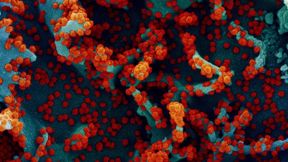 epa08959624 An undated handout image captured and color-enhanced at the National Institute of Allergy and Infectious Diseases (NIAID) Integrated Research Facility (IRF) in Fort Detrick, Maryland, USA and made available by the National Institutes of Health (NIH) shows a colorized scanning electron micrograph of a cell heavily infected with SARS-CoV-2 virus particles (red), isolated from a patient sample (issued 23 January 2021).The novel coronavirus SARS-COV-2, which causes the COVID-19 disease, has been recognized as a pandemic by the World Health Organization (WHO) on 11 March 2020.  EPA/NIAID/NATIONAL INSTITUTES OF HEALTH HANDOUT  HANDOUT EDITORIAL USE ONLY/NO SALES