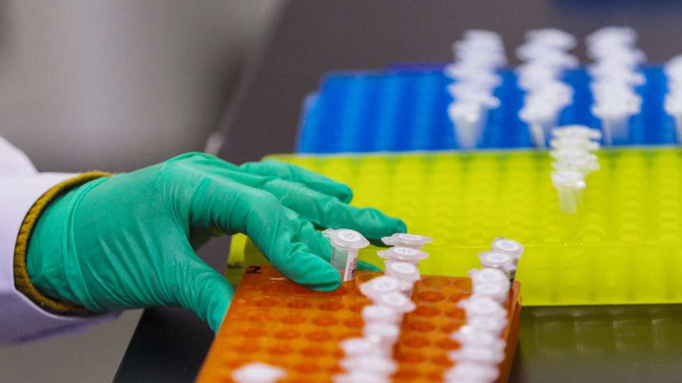 "O teste que o faz é a análise de marcadores genéticos [75 genes e 102 marcadores genéticos] para que a pessoa consiga ter mais informação acerca de si própria