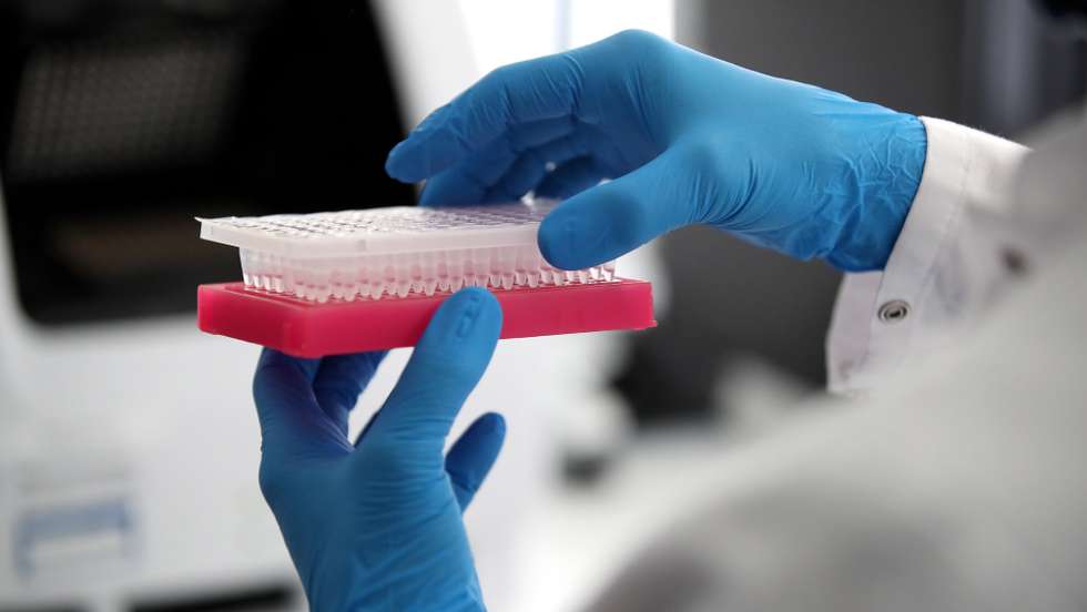 epa08715584 An employee removes COVID-19 samples from a Corona Diagnostig device at the Chemical and Veterinary Investigation Office (CVUA) in Muenster, Germany, 02 October 2020. In the laboratory for veterinary samples of the Chemical and Veterinary Investigation Office, up to 500 PCR examinations for the coronavirus are carried out daily.  EPA/FRIEDEMANN VOGEL
