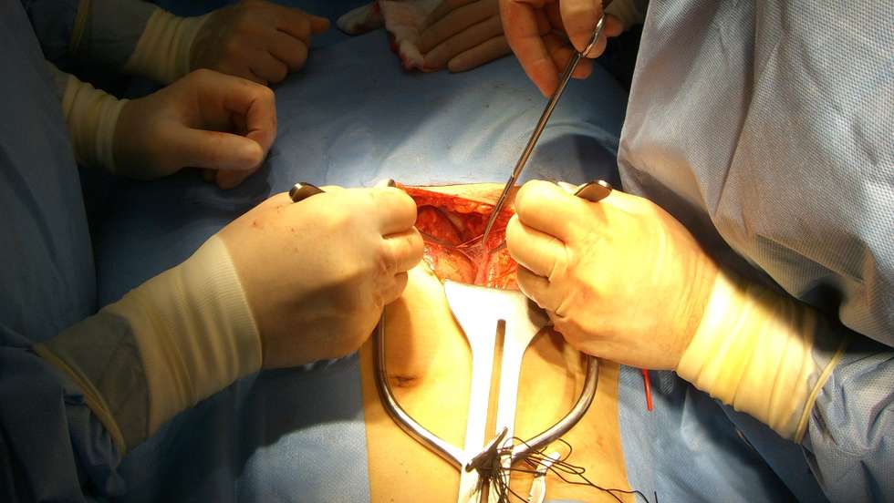 Duas horas e meia foi o tempo para Ana Pereira receber um rim do seu marido, no primeiro transplante com um dador vivo sem relação de consanguinidade realizado em Portugal, realizado no Hospital de Santa Cruz em Carnaxide, 13 de Fevereiro de 2008.  FOTOS CEDIDAS PELO HOSPITAL DE SANTA CRUZ. (ACOMPANHA TEXTO)  STR/LUSA