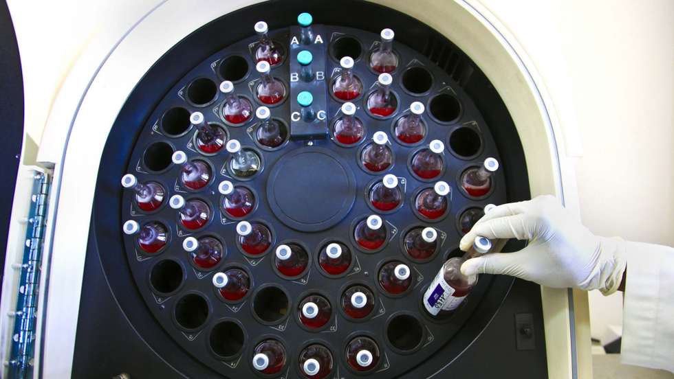 As hepatites virais continuam a representar importante causa de doença hepática crónica