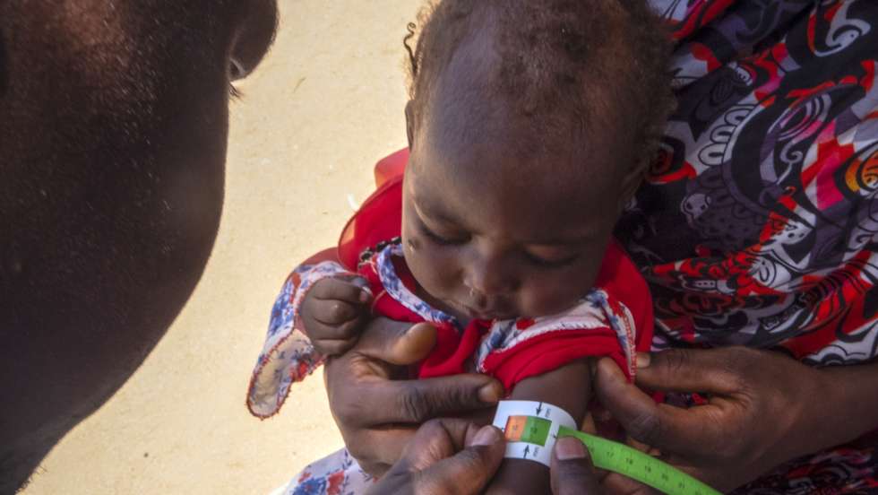 epa11267333 The arm size of a Sudanese child refugee suffering from malnutition is examined by a doctor at the hospital set up by the NGO Doctors Without Borders (MSF)at  the refugee camp of Metche, eastern Chad, 06 April 2024. (Issued 09 April 2024). The baby isdue to receive treatment for malnutrition, one of the many consequences of the humanitarian crises provoked by the war in neighbouring Sudan which started on 15 April 2023. According to the UNHCR in March 2024, in one year more than 500,00 Sudanese refugees, mainly from Darfur region, have crossed into Chad looking for safety, 90 percent of them are women and children. As different humanitarian crises are unfolding in other parts of the world, both the UN and NGOs like MSF keep appealing for more aid to reach Sudan and avoid a looming famine situation in the already strained socio-economic context of Chad.  EPA/STRINGER
