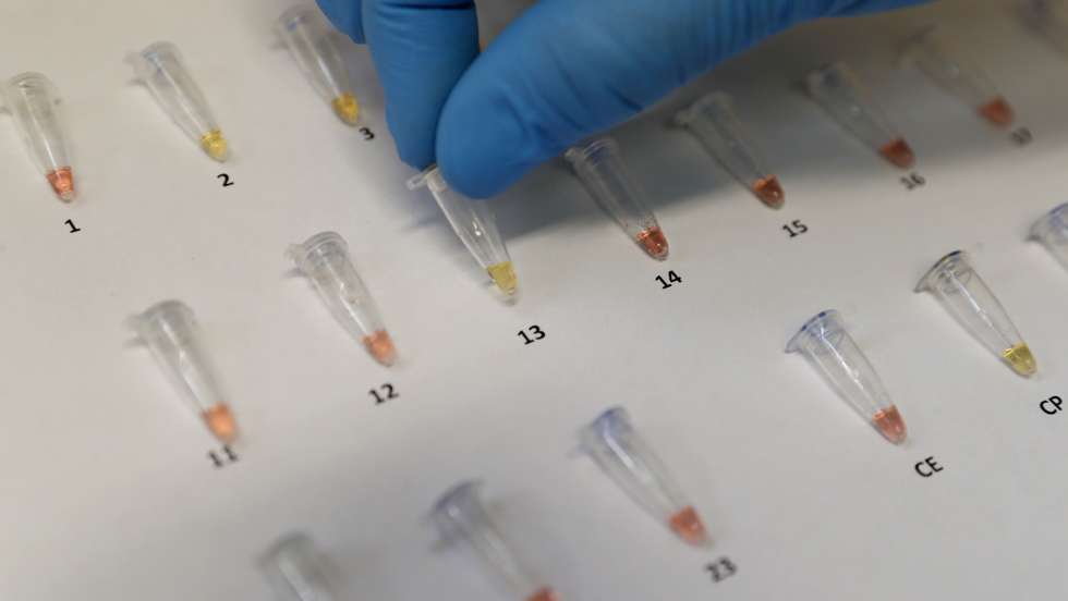 epaselect epa08730816 View of the extraction of the genetic code or ribonucleic acid (RNA) of the coronavirus, the same that is amplified to continue with the processing and achieve the result by means of a color reaction, positive yellow, negative red, in the laboratory of Hipolito Unanue Hospital, in Lima, Peru, 08 October 2020. The hospital is the second in Peru to launch the use of rapid molecular tests, a new technology that saves time to detect the presence of the virus in a similar way to PCR. These molecular tests, the results of which are ready in about 45 minutes, use the RT-LAMP technique (loop-mediated isothermal amplification), a method that is usually applied in Peru for the diagnosis of dengue, Zika and tuberculosis.  EPA/Paolo Aguilar