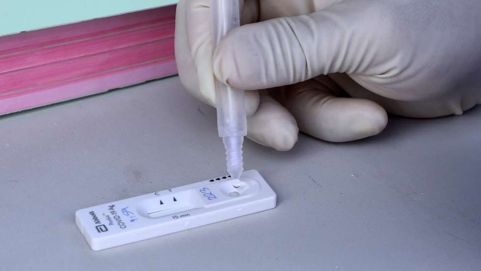 epa08826986 Cypriot medical personnel performs a SARS-CoV-2 Rapid Antigen Test just after collecting a swab in Nicosia, Cyprus, 18 November 2020. A special drive started for random COVID-19 testing throughout the island in an effort to curb a spike in coronavirus cases.  EPA/KATIA CHRISTODOULOU