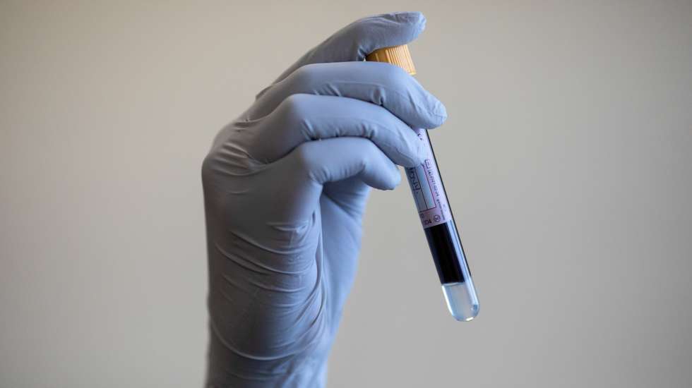 British Government Offers Antibody Tests To NHS And Care Home Staff