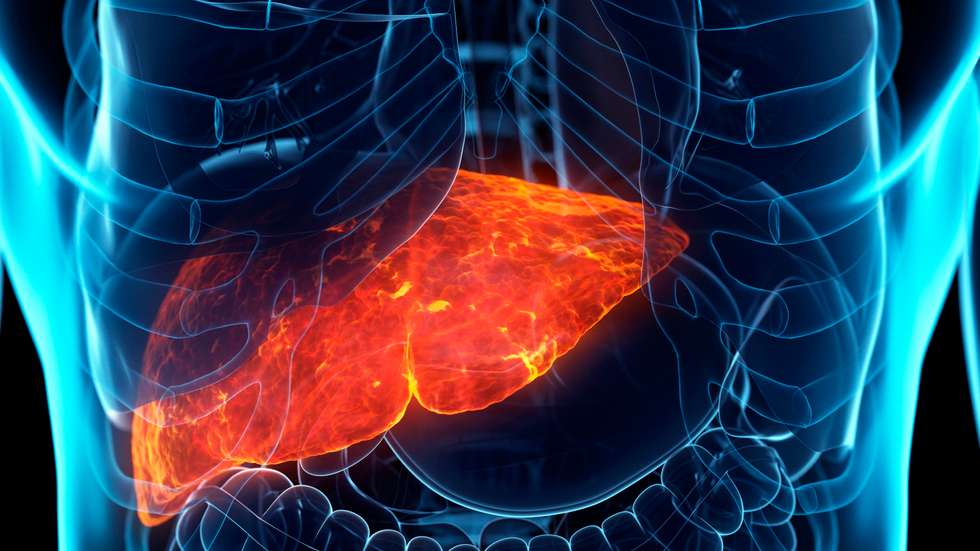 Diseased liver, conceptual illustration