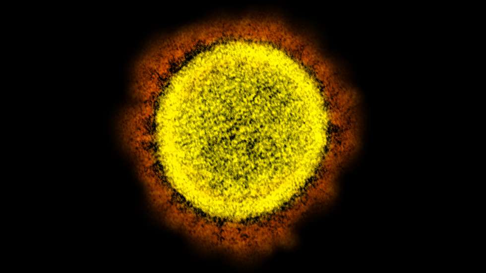 Novel coronavirus sars-cov-2