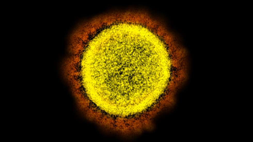 Novel coronavirus sars-cov-2
