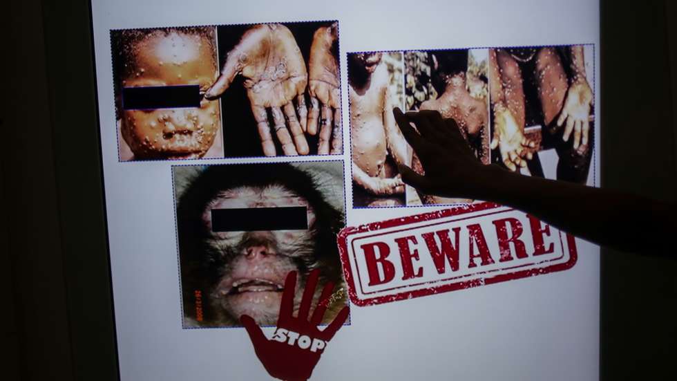 Monkeypox virus detection in Indonesia