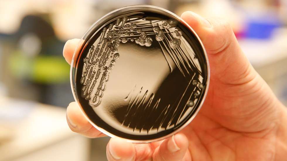 A bactéria da Legionella