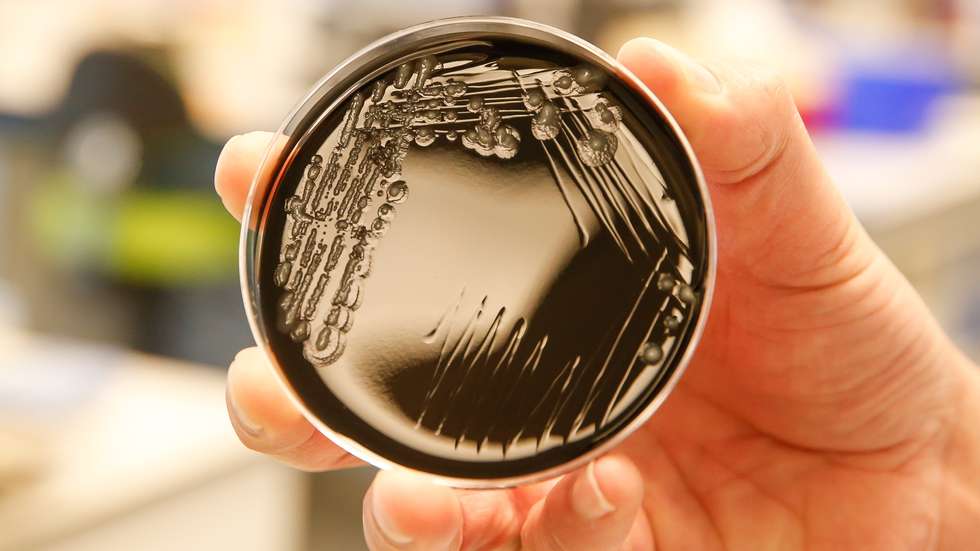 A bactéria da Legionella