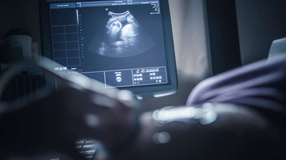 Pregnant woman having sonogram