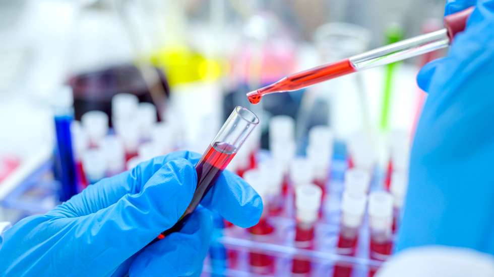 Scientist hand holding test tube with blood in laboratory.