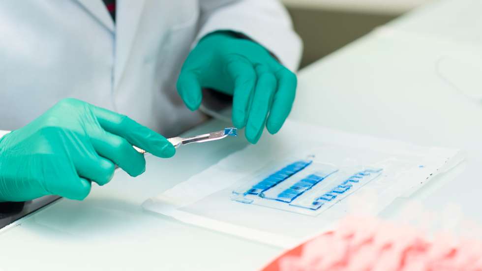 Proteomics: identification of proteins present in the samples. The electrophoresis gel bands containing proteins are recovered and placed in tubes.
