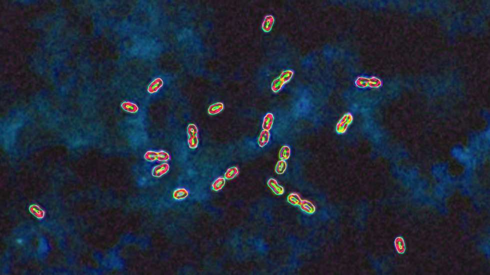 As doenças pneumocócicas são provocadas pela bactéria Streptococcus pneumoniae