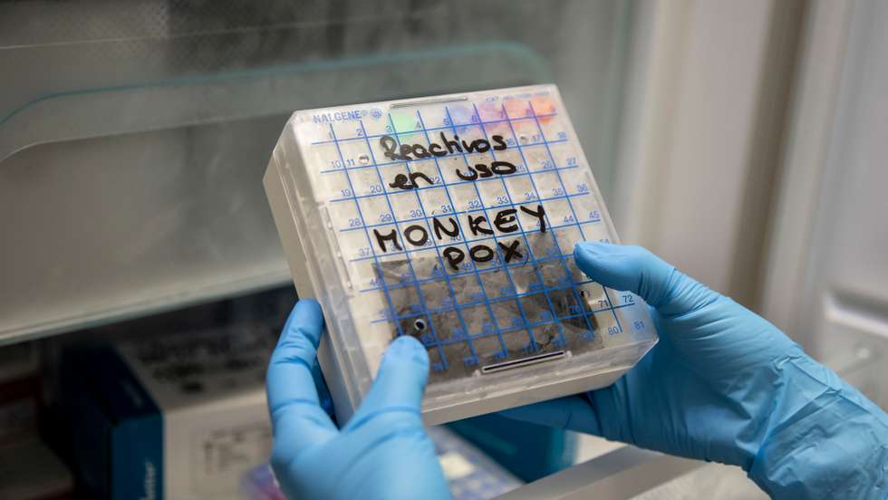 Spain Sets Up Monkeypox Testing Site As Cases on The Rise