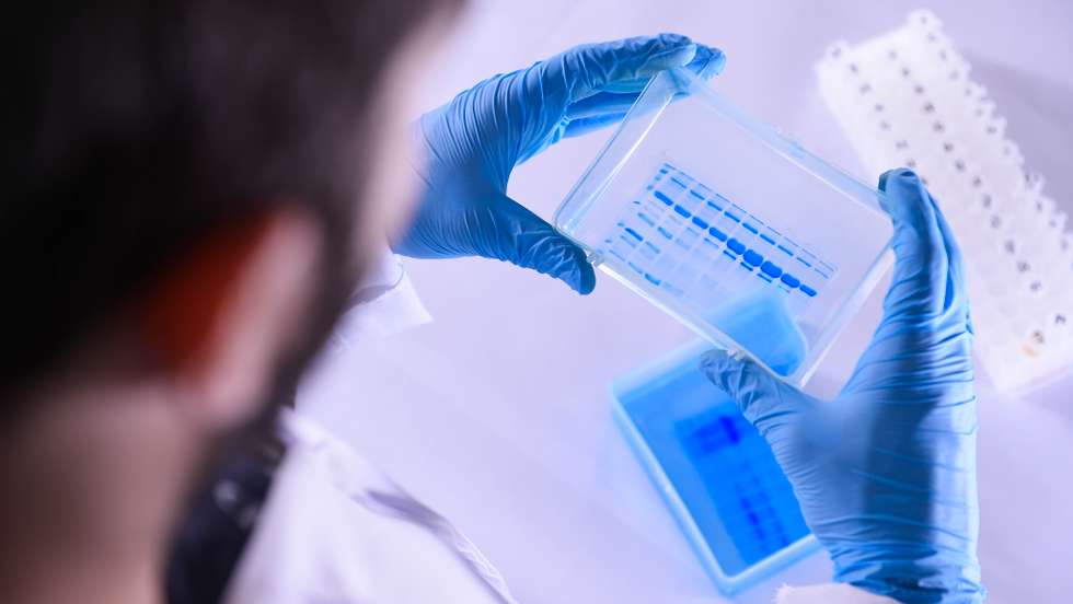 The Technological Vaccine Center of the Federal University of Minas Gerais is Testing a Vaccine against the Coronavirus (COVID - 19) and also Testing Diagnosis Kits