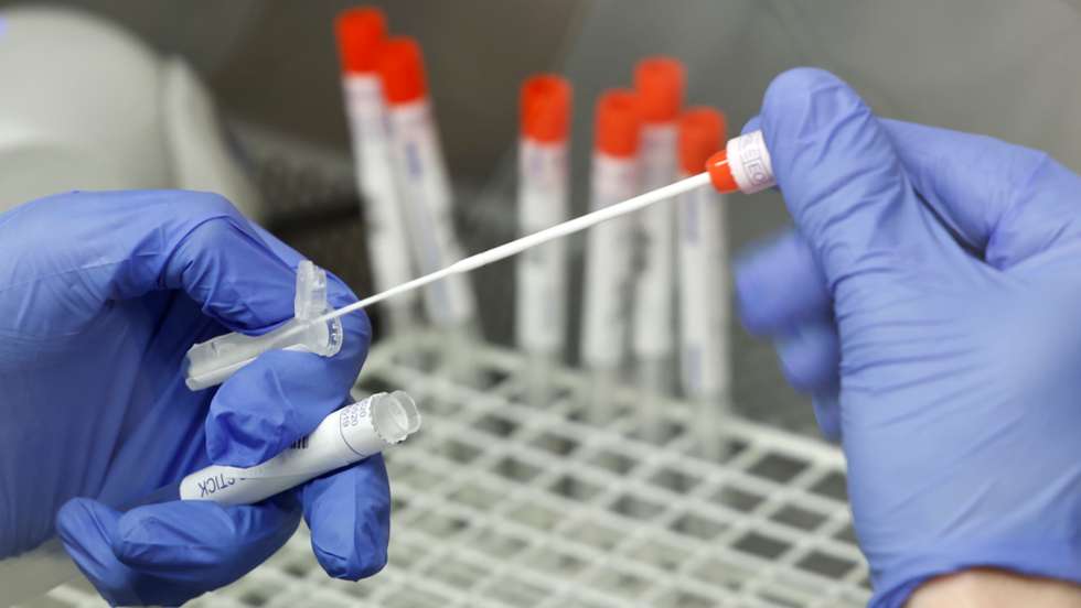 Teste PCR para o coronavírus