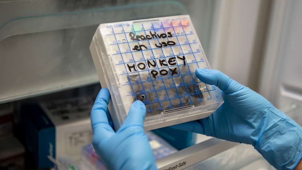 Spain Sets Up Monkeypox Testing Site As Cases on The Rise